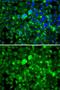 Ribosomal Protein Lateral Stalk Subunit P1 antibody, GTX33474, GeneTex, Immunofluorescence image 
