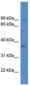 BRMS1 Like Transcriptional Repressor antibody, TA342944, Origene, Western Blot image 