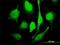 E3 ubiquitin-protein ligase MARCH7 antibody, H00064844-M01, Novus Biologicals, Immunofluorescence image 