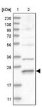 RAB17, Member RAS Oncogene Family antibody, PA5-57186, Invitrogen Antibodies, Western Blot image 