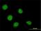 SSX Family Member 4B antibody, H00006759-M02, Novus Biologicals, Immunocytochemistry image 