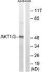 Akt antibody, TA313249, Origene, Western Blot image 