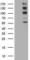 ALK Receptor Tyrosine Kinase antibody, TA801263, Origene, Western Blot image 