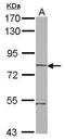 Rho Related BTB Domain Containing 1 antibody, GTX121574, GeneTex, Western Blot image 