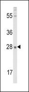 Fibroblast growth factor 10 antibody, PA5-15192, Invitrogen Antibodies, Western Blot image 