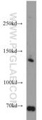 TSC Complex Subunit 1 antibody, 20988-1-AP, Proteintech Group, Western Blot image 