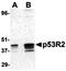 Ribonucleoside-diphosphate reductase subunit M2 B antibody, orb74435, Biorbyt, Western Blot image 