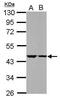 Chromosome 18 Open Reading Frame 25 antibody, PA5-28525, Invitrogen Antibodies, Western Blot image 