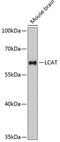 Lecithin-Cholesterol Acyltransferase antibody, GTX64822, GeneTex, Western Blot image 
