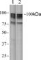 Mitogen-Activated Protein Kinase Kinase Kinase 14 antibody, 700281, Invitrogen Antibodies, Western Blot image 