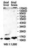 C-X-C Motif Chemokine Ligand 10 antibody, orb78225, Biorbyt, Western Blot image 