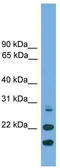 Anti-Silencing Function 1A Histone Chaperone antibody, TA344398, Origene, Western Blot image 