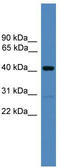 Proteasomal ubiquitin receptor ADRM1 antibody, TA342591, Origene, Western Blot image 