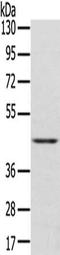 Delta Like Non-Canonical Notch Ligand 1 antibody, orb518830, Biorbyt, Western Blot image 