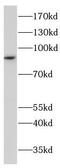 Chromodomain Helicase DNA Binding Protein 2 antibody, FNab01641, FineTest, Western Blot image 
