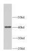 NudE Neurodevelopment Protein 1 antibody, FNab05600, FineTest, Western Blot image 