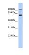 ArfGAP With Coiled-Coil, Ankyrin Repeat And PH Domains 3 antibody, orb325739, Biorbyt, Western Blot image 
