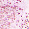 ATR Interacting Protein antibody, LS-C354219, Lifespan Biosciences, Immunohistochemistry paraffin image 