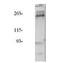 Insulin receptor substrate 2 antibody, PA1-30707, Invitrogen Antibodies, Immunoprecipitation image 