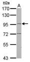 Leucine Rich Repeats And Guanylate Kinase Domain Containing antibody, PA5-29413, Invitrogen Antibodies, Western Blot image 