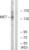 c-met antibody, LS-B8031, Lifespan Biosciences, Western Blot image 