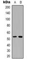 X-Linked Inhibitor Of Apoptosis antibody, orb338961, Biorbyt, Western Blot image 