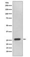 Ubiquitin C-Terminal Hydrolase L3 antibody, M05004, Boster Biological Technology, Western Blot image 