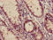 Adaptor Related Protein Complex 3 Subunit Mu 2 antibody, LS-C399420, Lifespan Biosciences, Immunohistochemistry paraffin image 
