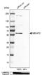 Membrane Bound O-Acyltransferase Domain Containing 2 antibody, NBP1-82236, Novus Biologicals, Western Blot image 