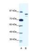 DNA replication licensing factor MCM8 antibody, NBP1-58130, Novus Biologicals, Western Blot image 