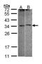 Four and a half LIM domains protein 5 antibody, PA5-21814, Invitrogen Antibodies, Western Blot image 