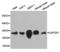 Capping Actin Protein Of Muscle Z-Line Subunit Alpha 2 antibody, LS-C192713, Lifespan Biosciences, Western Blot image 