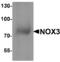 NADPH Oxidase 3 antibody, TA349082, Origene, Western Blot image 