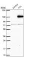 AXL Receptor Tyrosine Kinase antibody, HPA037423, Atlas Antibodies, Western Blot image 
