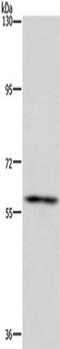 FTO Alpha-Ketoglutarate Dependent Dioxygenase antibody, TA349997, Origene, Western Blot image 