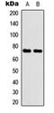 ATP Binding Cassette Subfamily G Member 2 (Junior Blood Group) antibody, orb234988, Biorbyt, Western Blot image 