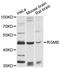 Repulsive Guidance Molecule BMP Co-Receptor B antibody, STJ114725, St John