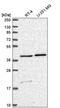 Solute Carrier Family 18 Member B1 antibody, PA5-65574, Invitrogen Antibodies, Western Blot image 