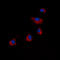Arrestin Domain Containing 4 antibody, GTX56083, GeneTex, Immunocytochemistry image 