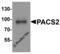 Phosphofurin Acidic Cluster Sorting Protein 2 antibody, 8189, ProSci Inc, Western Blot image 