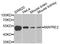 Microtubule-associated protein RP/EB family member 2 antibody, STJ28732, St John