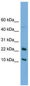 GM2 Ganglioside Activator antibody, TA338963, Origene, Western Blot image 