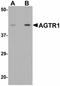 Angiotensin II type-1 receptor antibody, LS-B4614, Lifespan Biosciences, Western Blot image 
