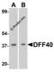 DNA fragmentation factor subunit beta antibody, 2155, ProSci Inc, Western Blot image 