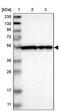 FKBP Prolyl Isomerase 1B antibody, PA5-52952, Invitrogen Antibodies, Western Blot image 
