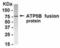 ATP Synthase F1 Subunit Beta antibody, NB100-75604, Novus Biologicals, Western Blot image 