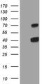 C-Type Lectin Domain Family 1 Member A antibody, M15410, Boster Biological Technology, Western Blot image 