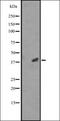 Cyclin Dependent Kinase 20 antibody, orb335470, Biorbyt, Western Blot image 