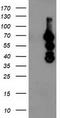 Katanin p80 WD40-containing subunit B1 antibody, TA503760AM, Origene, Western Blot image 