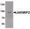 Janus Kinase And Microtubule Interacting Protein 2 antibody, PA5-34496, Invitrogen Antibodies, Western Blot image 